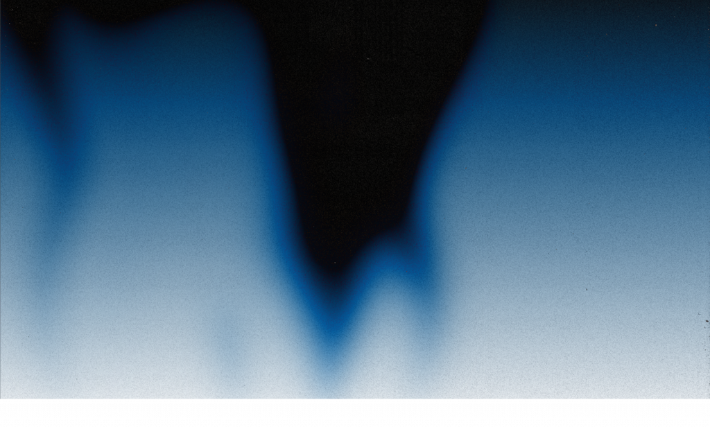 Візуалізація втрати зубів внаслідок катувань у полоні проєкт Re:Smile АЗОВ.Супровід